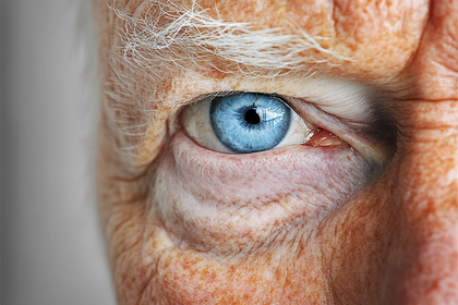 Close Up Of Elderly Blue Eye